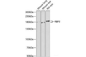 Western blot analysis of extracts of various cell lines using RBP3 Polyclonal Antibody at dilution of 1:1000. (RBP3 抗体)