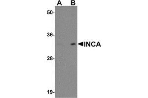 Western blot analysis of INCA1 in EL4 cell lysate with AP30433PU-N INCA1 antibody at (A) 1 and (B) 2 μg/ml. (INCA1 抗体  (C-Term))