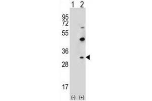 Western blot analysis of CLDN2 (arrow) using rabbit polyclonal CLDN2 Antibody (pTyr195) . (Claudin 2 抗体  (C-Term))