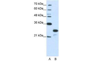 WB Suggested Anti-ANP32A  Antibody Titration: 1. (PHAP1 抗体  (N-Term))