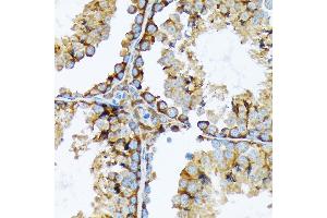 Immunohistochemistry (IHC) image for anti-Cortactin (CTTN) antibody (ABIN7266511)