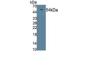 Detection of Recombinant LIPD, Mouse using Polyclonal Antibody to Lipoprotein lipase (LPL) (Lipoprotein Lipase 抗体)