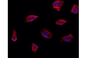 ABIN6264557 and ABIN6273304 staining Hela by IF/ICC. (RAB14 抗体  (C-Term))