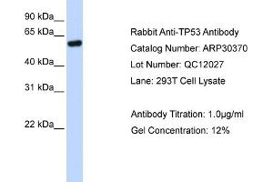 WB Suggested Anti-TP53 Antibody Titration: 0. (p53 抗体  (N-Term))