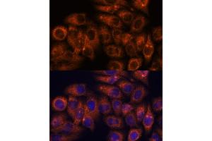 Immunofluorescence analysis of HeLa cells using STE antibody (ABIN7270588) at dilution of 1:100. (STEAP4 抗体  (AA 1-100))