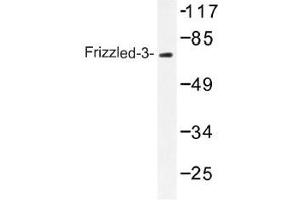 Image no. 1 for anti-Frizzled Family Receptor 3 (FZD3) antibody (ABIN317750) (FZD3 抗体)