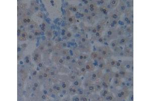 Used in DAB staining on fromalin fixed paraffin- embedded liver tissue (CBY1/PGEA1 抗体  (AA 7-127))