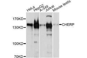 Western blot analysis of extracts of various cell lines, using CHERP antibody (ABIN5996299) at 1/1000 dilution. (CHERP 抗体)