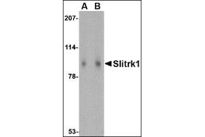 Western blot analysis of Slitrk1 in human brain tissue lysate with this product at (A) 1 and (B) 2 μg/ml. (SLITRK1 抗体  (Middle Region))