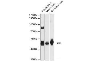 Western blot analysis of extracts of various cell lines using CKB Polyclonal Antibody at dilution of 1:3000. (CKB 抗体)