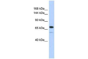 WB Suggested Anti-CALD1 Antibody Titration:  0. (Caldesmon 抗体  (Middle Region))