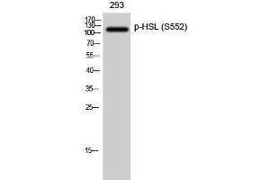 Western Blotting (WB) image for anti-Lipase, Hormone-Sensitive (LIPE) (pSer552) antibody (ABIN3182522) (LIPE 抗体  (pSer552))