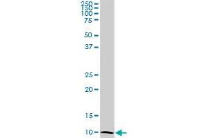 ATP6V1G2 monoclonal antibody (M02), clone 2E11. (ATP6V1G2 抗体  (AA 41-118))