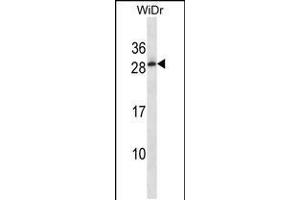 Western blot analysis in WiDr cell line lysates (35ug/lane). (Testis Expressed 40 (TEX40) (AA 172-200), (C-Term) 抗体)