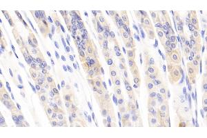 Detection of CCL1 in Mouse Stomach Tissue using Polyclonal Antibody to Chemokine C-C-Motif Ligand 1 (CCL1) (CCL1 抗体  (AA 24-92))
