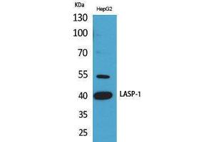 Western Blotting (WB) image for anti-LIM and SH3 Protein 1 (LASP1) (Internal Region) antibody (ABIN3178265) (LASP1 抗体  (Internal Region))