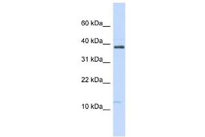 Western Blotting (WB) image for anti-serine Peptidase Inhibitor, Kazal Type 1 (SPINK1) (N-Term) antibody (ABIN633881)