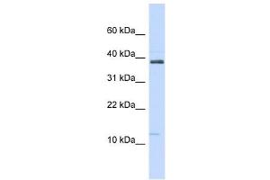 SPINK1 antibody used at 1 ug/ml to detect target protein. (SPINK1 抗体  (N-Term))