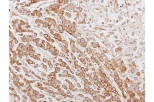 IHC-P Image Immunohistochemical analysis of paraffin-embedded MDA-MB468 xenograft, using NYD-SP26, antibody at 1:100 dilution. (CABS1 抗体  (Center))