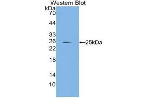 Western blot analysis of the recombinant protein. (Laminin alpha 1 抗体  (AA 41-230))
