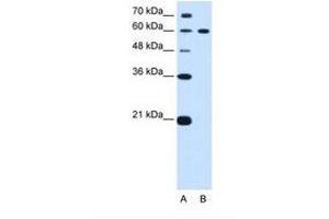 Image no. 1 for anti-Deltex Homolog 2 (DTX2) (AA 454-503) antibody (ABIN6739165) (DTX2 抗体  (AA 454-503))