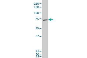 FBXL5 polyclonal antibody (A01), Lot # 051123JCS1 Western Blot analysis of FBXL5 expression in HepG2 . (FBXL5 抗体  (AA 584-691))