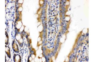 Immunohistochemistry (IHC) image for anti-CUB Domain Containing Protein 1 (CDCP1) (AA 582-667) antibody (ABIN4886532)