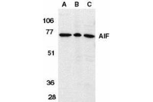 Western blot analysis of AIF in K562 cell lysate (A), rat heart (B), and mouse heart (C) tissue lysates with AP30030PU-N AIF antibody (IN) at 1 μg/ml. (AIF 抗体  (Intermediate Domain))