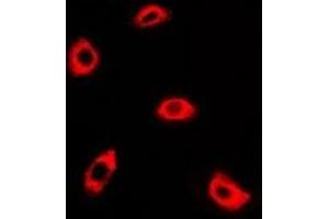 Immunofluorescent analysis of AK4 staining in A549 cells. (AK4 抗体)
