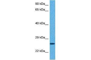 Host:  Rabbit  Target Name:  GSTA5  Sample Tissue:  Human Hela Whole Cell  Antibody Dilution:  1ug/ml (GSTa5 抗体  (Middle Region))