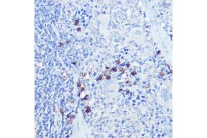 Immunohistochemistry of paraffin-embedded rat spleen using TLR9 Rabbit pAb (ABIN7270849) at dilution of 1:100 (40x lens). (TLR9 抗体  (AA 350-450))