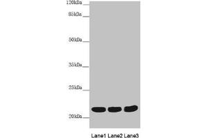 Western blot All lanes: MYL3 antibody at 3. (MYL3/CMLC1 抗体  (AA 1-195))
