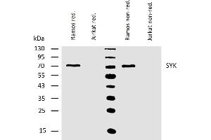 Western blotting analysis of human Syk using mouse monoclonal antibody SYK-01 on lysates of Ramos and Jurkat (negative control) cells under reducing and non-reducing conditions. (SYK 抗体  (AA 5-360))