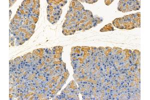 ABIN7094578 and ABIN7098627 at 1/100 staining Rat pancreatic tissue by IHC-P.