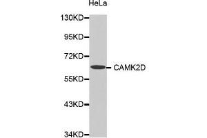 Western Blotting (WB) image for anti-Calcium/calmodulin-Dependent Protein Kinase II delta (CAMK2D) (AA 1-260) antibody (ABIN6213921) (CAMK2D 抗体  (AA 1-260))