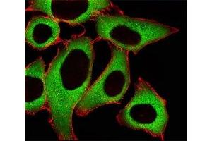 Fluorescent image of A549 cells stained with ALDH1A1 antibody at 1:25.