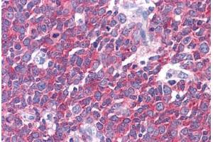 Human Tonsil: Formalin-Fixed, Paraffin-Embedded (FFPE) (LMTK2 抗体  (AA 1181-1280))