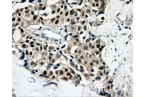 Immunohistochemical staining of paraffin-embedded thyroid tissue using anti-CAMK1Dmouse monoclonal antibody. (CAMK1D 抗体)