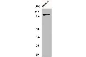 Western Blot analysis of Jurkat cells using DDX54 Polyclonal Antibody (DDX54 抗体  (Internal Region))