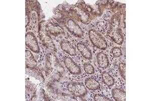 Immunohistochemical staining of human stomach with C9orf167 polyclonal antibody  shows moderate cytoplasmic positivity in glandular cells at 1:10-1:20 dilution. (TOR4A 抗体)