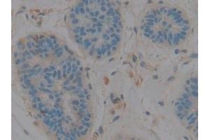 Immunohistochemistry (IHC) image for anti-Complement Component 3 (C3) (AA 1000-1326) antibody (ABIN7432772)