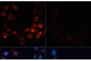 Immunofluorescence analysis of NIH/3T3 cells using Phospho-γH2A. (gamma H2AX 抗体  (pSer139))