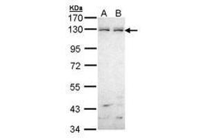 Image no. 1 for anti-EPH Receptor B6 (EPHB6) (AA 793-977) antibody (ABIN467545) (EPH Receptor B6 抗体  (AA 793-977))