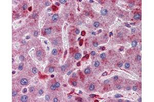 Immunohistochemistry (IHC) image for anti-Acid Phosphatase 2, Lysosomal (ACP2) (Middle Region) antibody (ABIN2782134) (ACP2 抗体  (Middle Region))