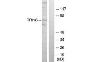 Western blot analysis of extracts from 293 cells, using TRI18 Antibody. (MID1 抗体  (AA 71-120))