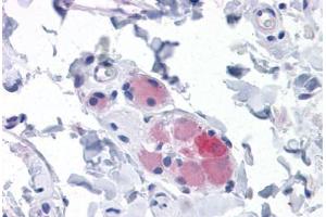 Human Small Intestine, submucosal plexus: Formalin-Fixed, Paraffin-Embedded (FFPE) (STIM1 抗体  (AA 24-686))