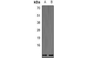 Western blot analysis of Defensin beta 132 expression in mouse testis (A), mouse liver (B) whole cell lysates. (DEFB132 抗体)