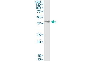 DGAT2 monoclonal antibody (M03), clone 4C1. (DGAT2 抗体  (AA 289-388))