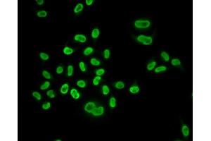 Immunofluorescence analysis of U2OS cells using MCM6 antibody. (MCM6 抗体)