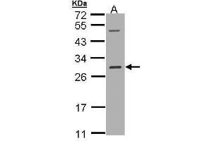 Western Blotting (WB) image for anti-V-Ral Simian Leukemia Viral Oncogene Homolog B (Ras Related, GTP Binding Protein) (Ralb) (full length) antibody (ABIN2856651)